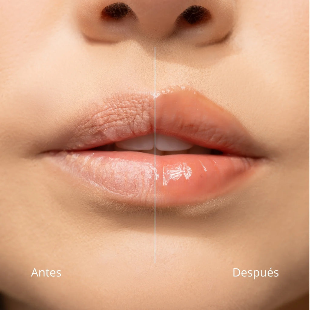 Lip Balm - ANI-K